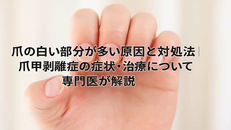 爪の白い部分が多い原因と対処法｜爪甲剥離症の症状・治療について専門医が解説