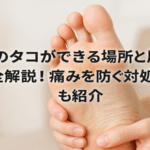 足裏のタコができる場所と原因を完全解説！痛みを防ぐ対処法も紹介
