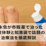 爪水虫が市販薬で治った実体験と知恵袋で話題の治療法を徹底解説