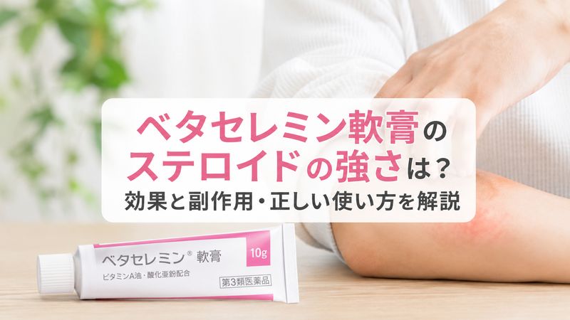 ベタセレミン軟膏のステロイドの強さは？効果と副作用・正しい使い方を解説