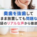 奥歯を抜歯してそのまま放置しても問題ない？知恵袋のリアルな声から徹底解説